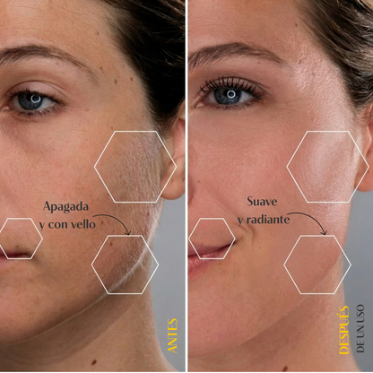 Professional Skin Transformation Tool, 2-in-1: Removes Peach-Fuzz & Exfoliates for Instant Spa-Smooth Skin