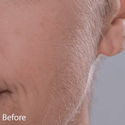 Professional Skin Transformation Tool, 2-in-1: Removes Peach-Fuzz & Exfoliates for Instant Spa-Smooth Skin